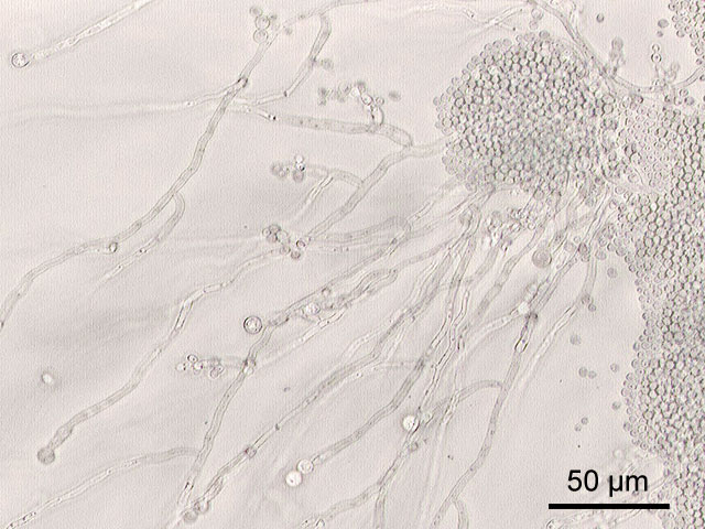 Candidassi, candida, candida albicans